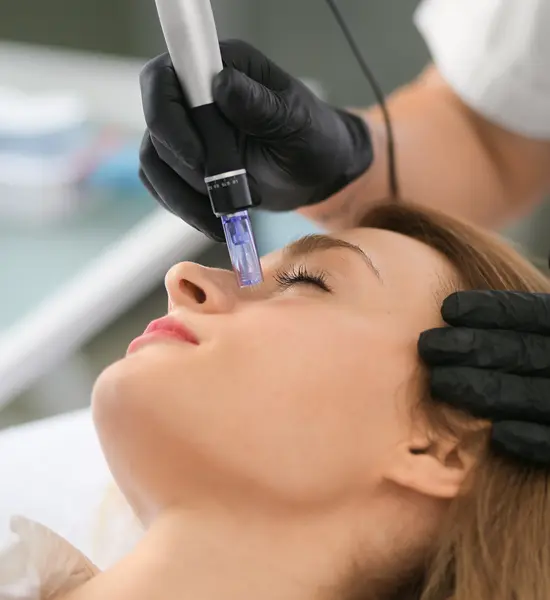 SkinPen PRP (Pkg 3)